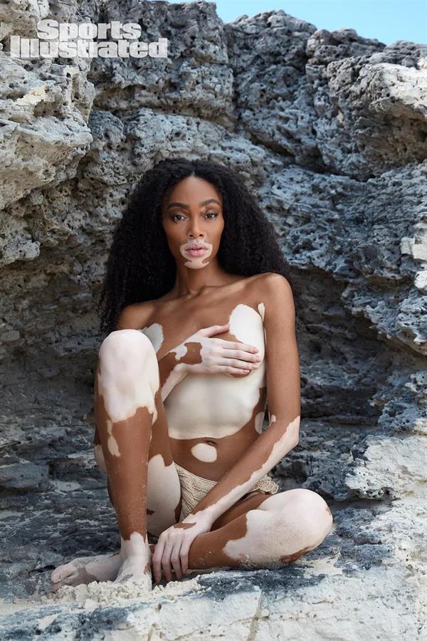 Winnie Harlow - Sports Illustrated Swimsuit Issue 2019: Great Exuma