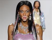 Winnie Harlow