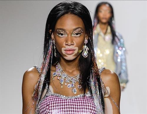 Winnie Harlow