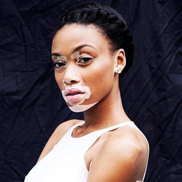 Winnie Harlow