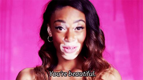 Winnie Harlow