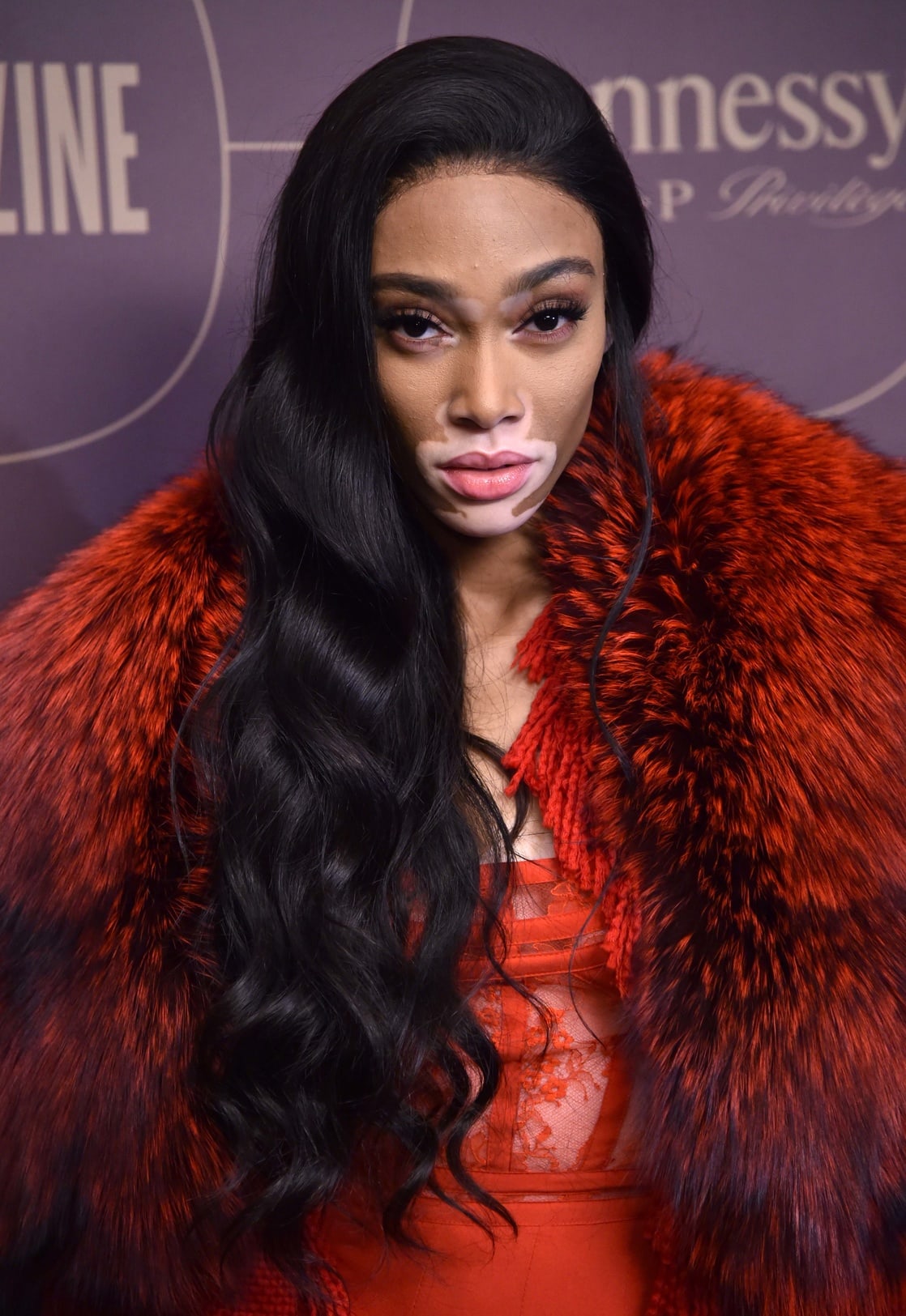 Winnie Harlow