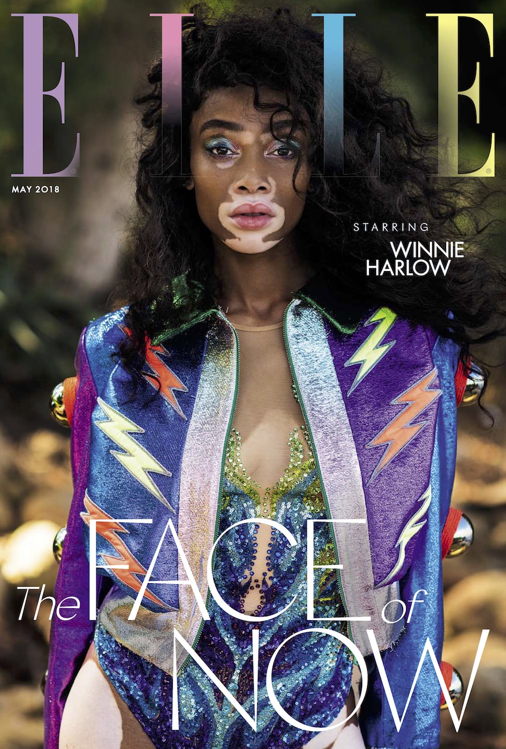 Winnie Harlow