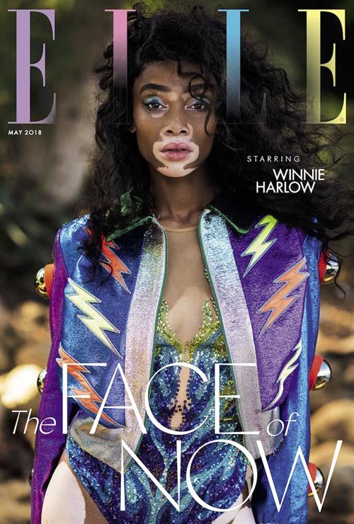 Winnie Harlow