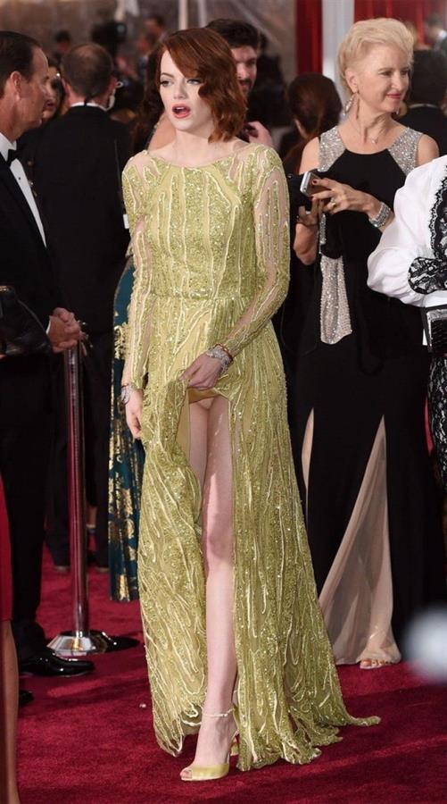 Emma Stone upskirt wardrobe malfunction on the red carpet showing her legs and panties caught by paparazzi.
